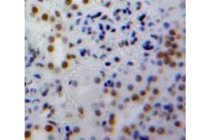 Used in DAB staining on fromalin fixed paraffin-embedded Kidney tissue (PPIE 抗体  (AA 41-264))