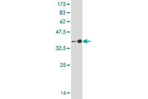 Western Blot detection against Immunogen (37 KDa) . (PCYT2 抗体  (AA 25-123))