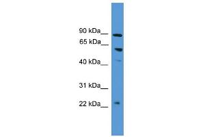 WB Suggested Anti-PDZK1  Antibody Titration: 0. (PDZK1 抗体  (N-Term))