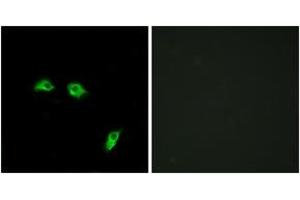 Immunofluorescence analysis of HeLa cells, using GABBR1 Antibody. (GABBR1 抗体  (AA 891-940))