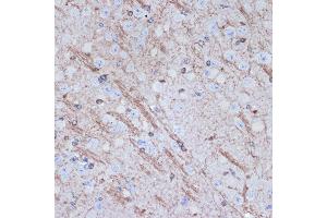 Immunohistochemistry of paraffin-embedded mouse brain using TMOD2 Rabbit mAb (ABIN7271011) at dilution of 1:100 (40x lens). (TMOD2 抗体)
