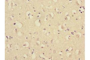 Immunohistochemistry of paraffin-embedded human brain tissue using ABIN7151282 at dilution of 1:100 (TRIM69 抗体  (AA 1-341))