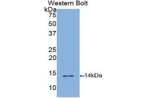 Western blot analysis of the recombinant protein. (INHBB 抗体  (AA 277-391))