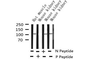 Western blot analysis of Phospho-PKD1/2/3/PKC μ (Ser738+Ser742) expression in various lysates (PKD1/2/3/PKC mu (pSer738), (pSer742) 抗体)