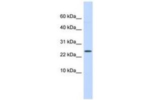 LYPD6 antibody  (C-Term)