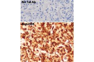 Immunohistochemistry (IHC) image for anti-CD5 (CD5) (AA 105-210) antibody (ABIN7272988)
