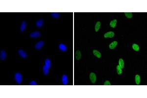 Immunofluorescence analysis of Hela cells using CBX1 mouse mAb (green). (CBX1 抗体)