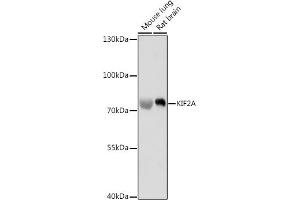 Western blot analysis of extracts of various cell lines, using KIF2A antibody (ABIN7268138) at 1:1000 dilution. (KIF2A 抗体  (AA 30-220))