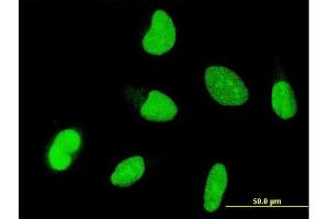 Immunofluorescence of monoclonal antibody to OTX1 on HeLa cell. (OTX1 抗体  (AA 10-116))