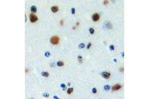 Immunohistochemical analysis of PWWP2B staining in human brain formalin fixed paraffin embedded tissue section. (PWWP2B 抗体)