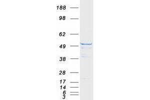 Western Blotting (WB) image for Tubulin, beta 3 (TUBB3) protein (Myc-DYKDDDDK Tag) (ABIN2734576)
