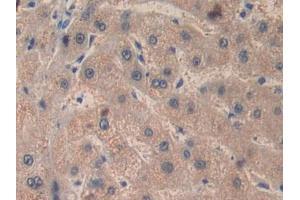 DAB staining on IHC-P;;Samples: Human Liver Tissue