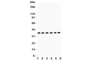 Western blot testing of Rad51 antibody and Lane 1:  22RV1 (RAD51 抗体  (AA 1-258))