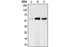 Western blot analysis of CHK1 (pS317) expression in HeLa (A), mouse kidney (B), rat heart (C) whole cell lysates. (CHEK1 抗体  (pSer317))