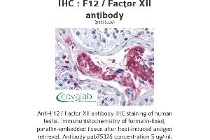 Image no. 2 for anti-Coagulation Factor XII (F12) antibody (ABIN1734212) (F12 抗体)