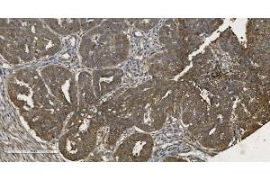IHC analysis of MPI using anti-MPI antibody (ABIN7600514).