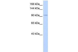WB Suggested Anti-SALL3 Antibody Titration:  0. (SALL3 抗体  (Middle Region))