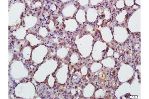 Paraformaldehyde-fixed, paraffin embedded Rat Lung Antigen retrieval by boiling in sodium citrate buffer (pH6. (TGFB1 抗体  (AA 351-390))