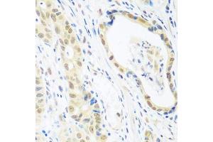 Immunohistochemistry (Paraffin-embedded Sections) (IHC (p)) image for anti-Polymerase (RNA) II (DNA Directed) Polypeptide E, 25kDa (POLR2E) (AA 1-210) antibody (ABIN3022495)