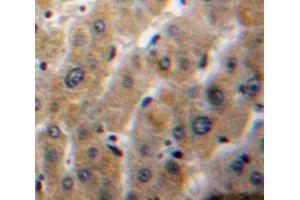 Used in DAB staining on fromalin fixed paraffin-embedded Liver tissue (PLA1A 抗体  (AA 148-295))