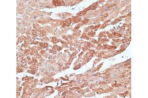 Immunohistochemistry of paraffin-embedded Mouse heart using TMX1 Polyclonal Antibody at dilution of 1:100 (40x lens). (TMX1 抗体)