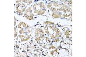 Immunohistochemistry of paraffin-embedded human stomach using IFNL1 antibody at dilution of 1:100 (40x lens). (IL29 抗体)