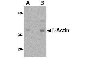 Image no. 1 for anti-Actin, beta (ACTB) (N-Term) antibody (ABIN341736) (beta Actin 抗体  (N-Term))