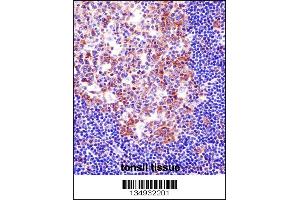 Immunohistochemistry (IHC) image for anti-Spleen Focus Forming Virus (SFFV) Proviral Integration Oncogene Spi1 (SPI1) (AA 217-246), (C-Term) antibody (ABIN5537382)