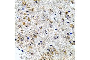 Immunohistochemistry of paraffin-embedded mouse brain using CAST antibody (ABIN3015047, ABIN3015048, ABIN5663576 and ABIN6213614) at dilution of 1:100 (40x lens). (Calpastatin 抗体  (C-Term))