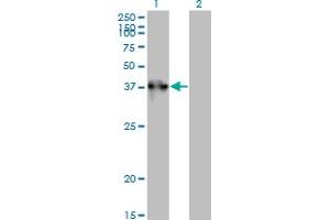 Western Blot analysis of TEX264 expression in transfected 293T cell line by TEX264 monoclonal antibody (M01), clone 2A3-1A10. (TEX264 抗体  (AA 1-313))