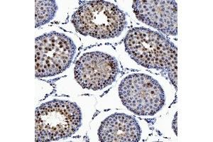 IHC analysis of SSRP1 using anti-SSRP1 antibody (ABIN7600496). (SSRP1 抗体  (AA 2-381))