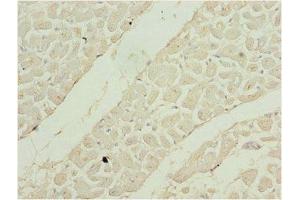 Immunohistochemistry of paraffin-embedded human heart tissue using ABIN7169525 at dilution of 1:100 (SHOX2 抗体  (AA 72-331))