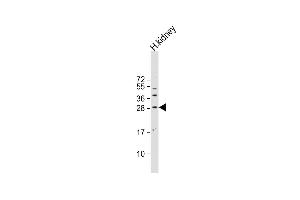 Anti-SOST Antibody (N-term) at 1:500 dilution + human kidney lysate Lysates/proteins at 20 μg per lane. (Sclerostin 抗体  (N-Term))