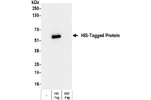 Western Blotting (WB) image for anti-His Tag antibody (ABIN7795586)