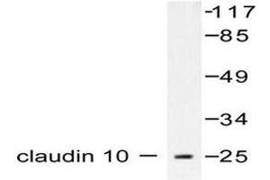 Image no. 1 for anti-Claudin 10 (CLDN10) antibody (ABIN265359) (CLDN10 抗体)