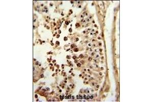 Formalin-fixed and paraffin-embedded human testis tissue reacted with P3R2 Antibody (N-term), which was peroxidase-conjugated to the secondary antibody, followed by DAB staining. (Calcineurin B 抗体  (N-Term))