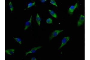 Immunofluorescence staining of U251 cells with ABIN7156793 at 1:50, counter-stained with DAPI. (IL13 Receptor alpha 1 抗体  (AA 22-234))