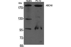 Western Blot (WB) analysis of specific cells using ABCA8 Polyclonal Antibody.