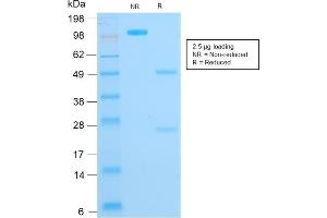 SDS-PAGE Analysis Purified Cytokeratin 16 Mouse Recombinant Monoclonal Antibody (KRT16/1714). (Recombinant KRT16 抗体  (C-Term))