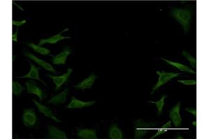 Immunofluorescence of monoclonal antibody to DST on HeLa cell. (Dystonin 抗体  (AA 401-500))
