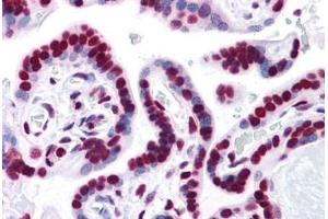 Human Placenta: Formalin-Fixed, Paraffin-Embedded (FFPE) (HMGB1 抗体  (AA 1-216))