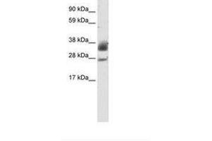 Image no. 1 for anti-Sirtuin 5 (SIRT5) (C-Term) antibody (ABIN202187) (SIRT5 抗体  (C-Term))