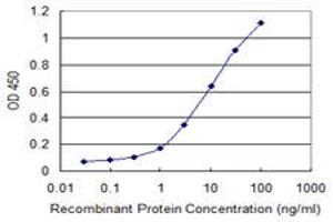Detection limit for recombinant GST tagged RAB7B is 0. (RAB7B 抗体  (AA 100-199))