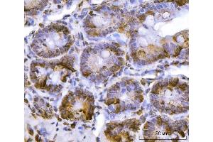 IHC analysis of RPL36 using anti-RPL36 antibody (ABIN7602917).