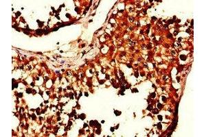 Immunohistochemistry of paraffin-embedded human testis tissue using ABIN7169181 at dilution of 1:100 (SIK1 抗体  (AA 492-750))