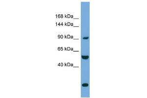 WB Suggested Anti-EXOC1 Antibody Titration: 0. (EXOC1 抗体  (N-Term))
