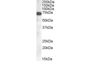 Image no. 1 for anti-Zinc Finger, DHHC-Type Containing 13 (ZDHHC13) (C-Term) antibody (ABIN374518) (ZDHHC13 抗体  (C-Term))