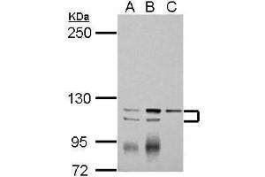 WB Image Sample (30 ug of whole cell lysate) A: Jurkat B: Raji C: K562 5% SDS PAGE antibody diluted at 1:2000 (ATP2A3 抗体  (N-Term))