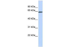 ANTXR1 antibody used at 1 ug/ml to detect target protein. (ANTXR1 抗体  (Middle Region))