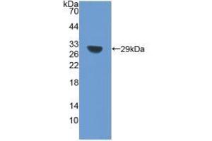 Western blot analysis of the recombinant protein. (SIRT1 抗体  (AA 238-482))